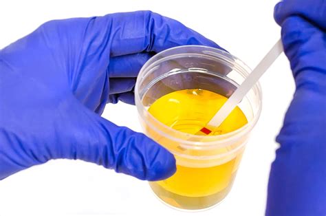 dropping urine strip test|rapid urine testing definition.